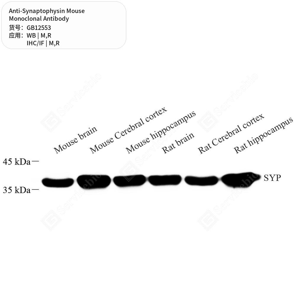 Антитела первичные, моноклональные мыши к Synaptophysin крысы, мыши, 50 мкл