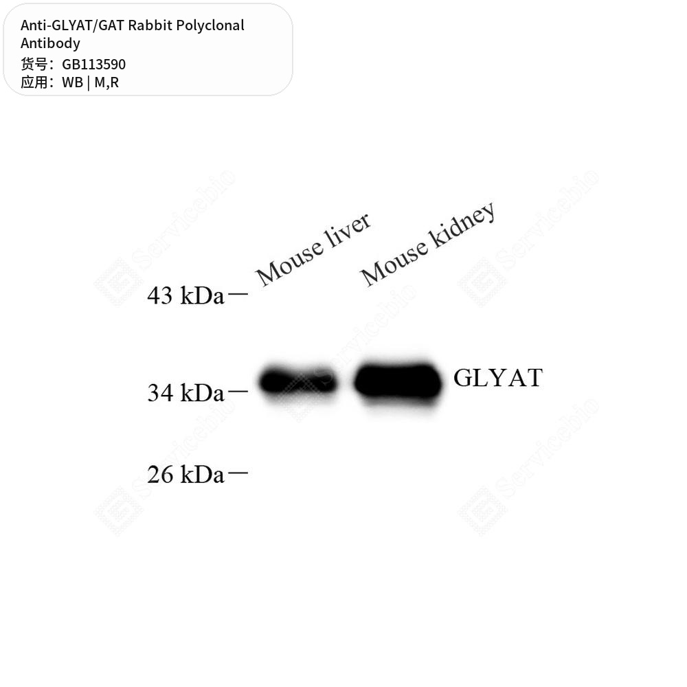 Антитела первичные, поликлональные кролика к GLYAT/GAT крысы, мыши, 100 мкл