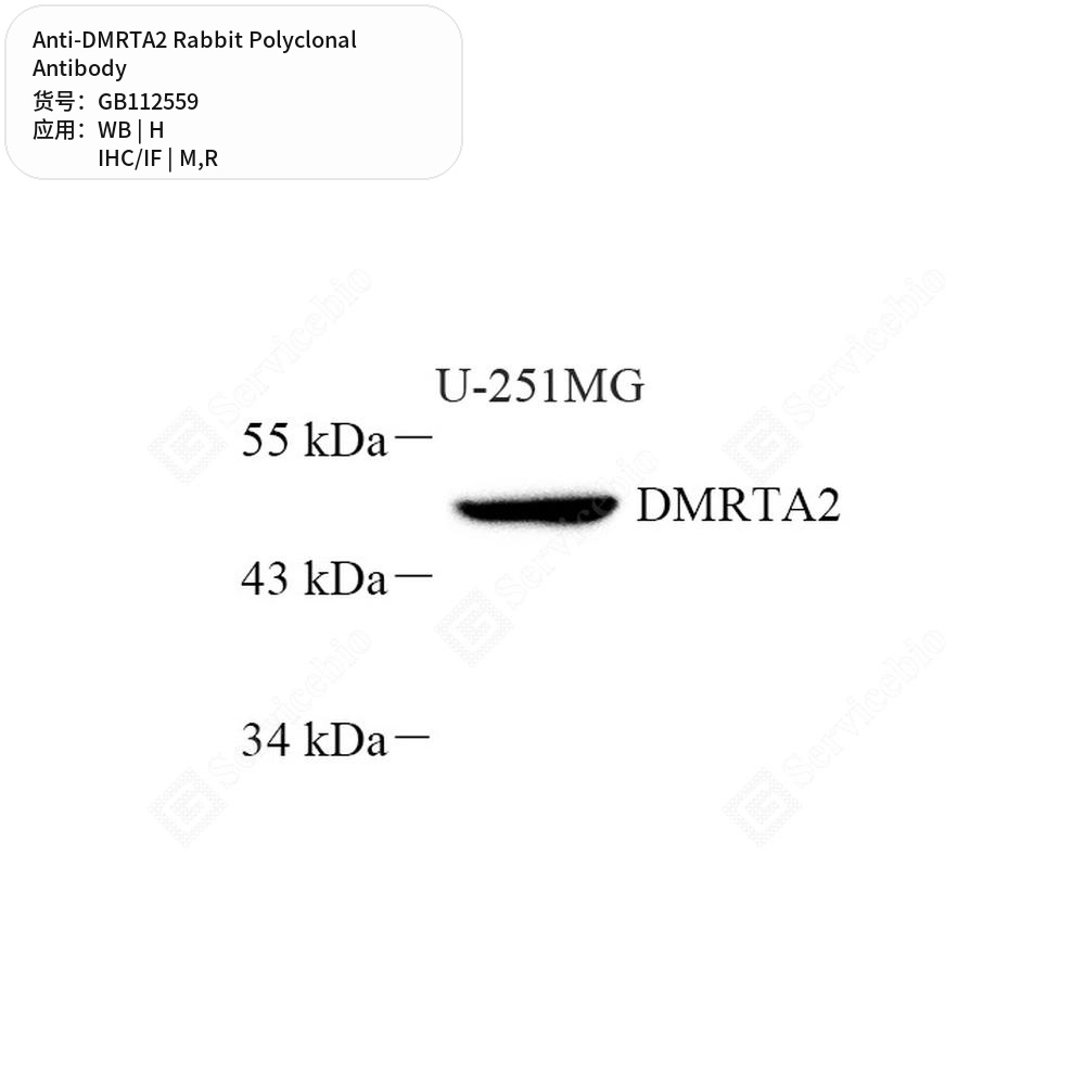 Антитела первичные, поликлональные кролика к DMRTA2 крысы, мыши, человека, 100 мкл