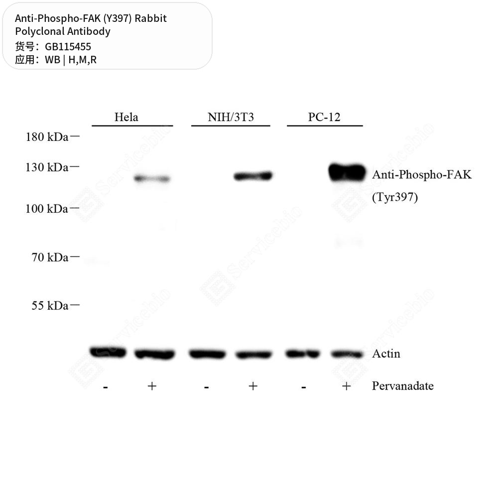 Антитела первичные, поликлональные кролика к Phospho-FAK (Y397) крысы, мыши, человека, 50 мкл