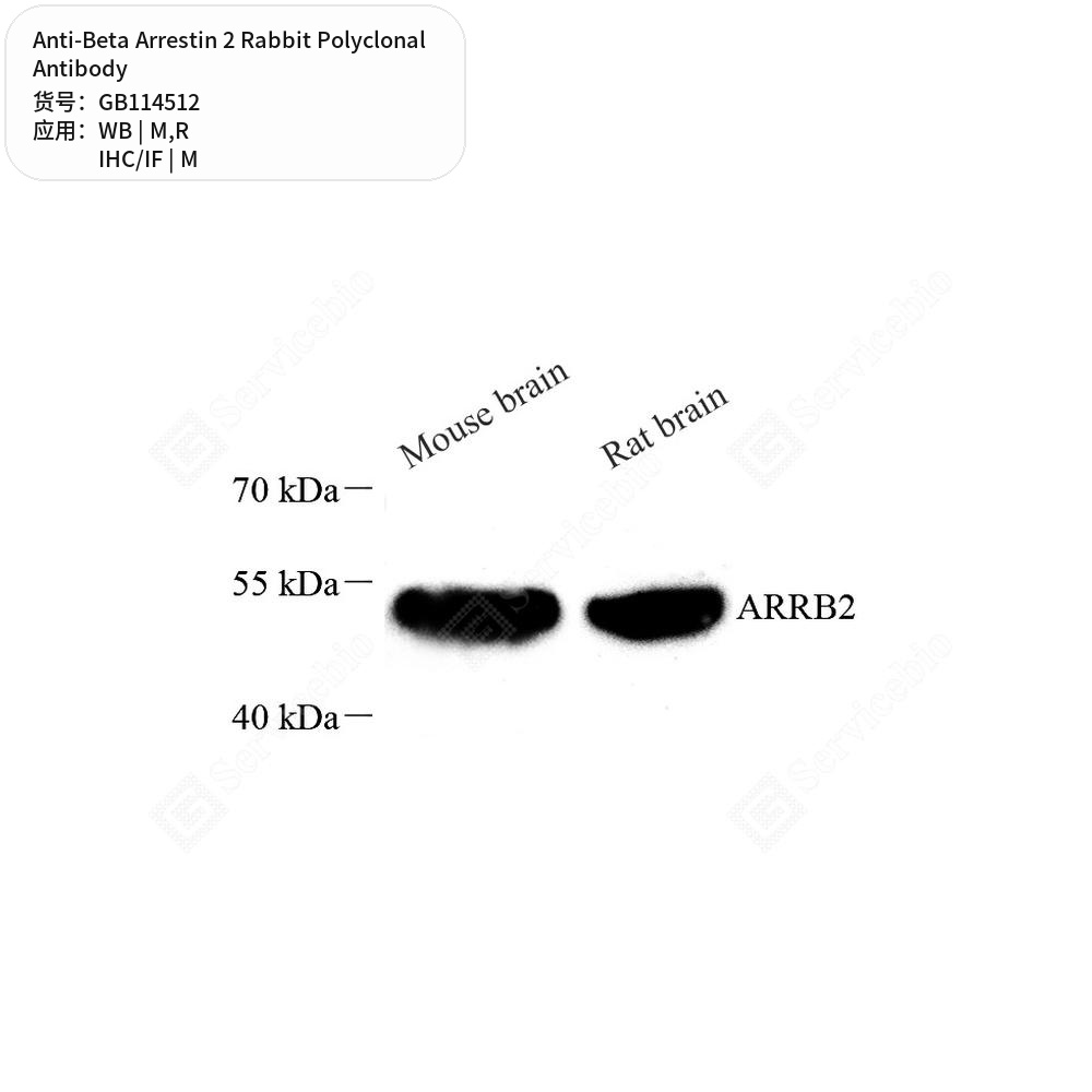 Антитела первичные, поликлональные кролика к Beta Arrestin 2 крысы, мыши, 50 мкл