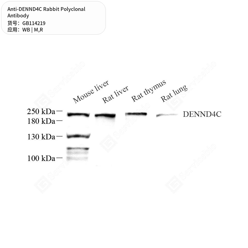 Антитела первичные, поликлональные кролика к DENND4C крысы, мыши, 50 мкл