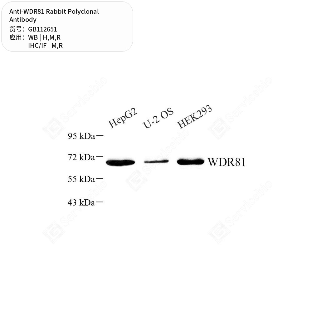 Антитела первичные, поликлональные кролика к WDR81 крысы, мыши, человека, 100 мкл
