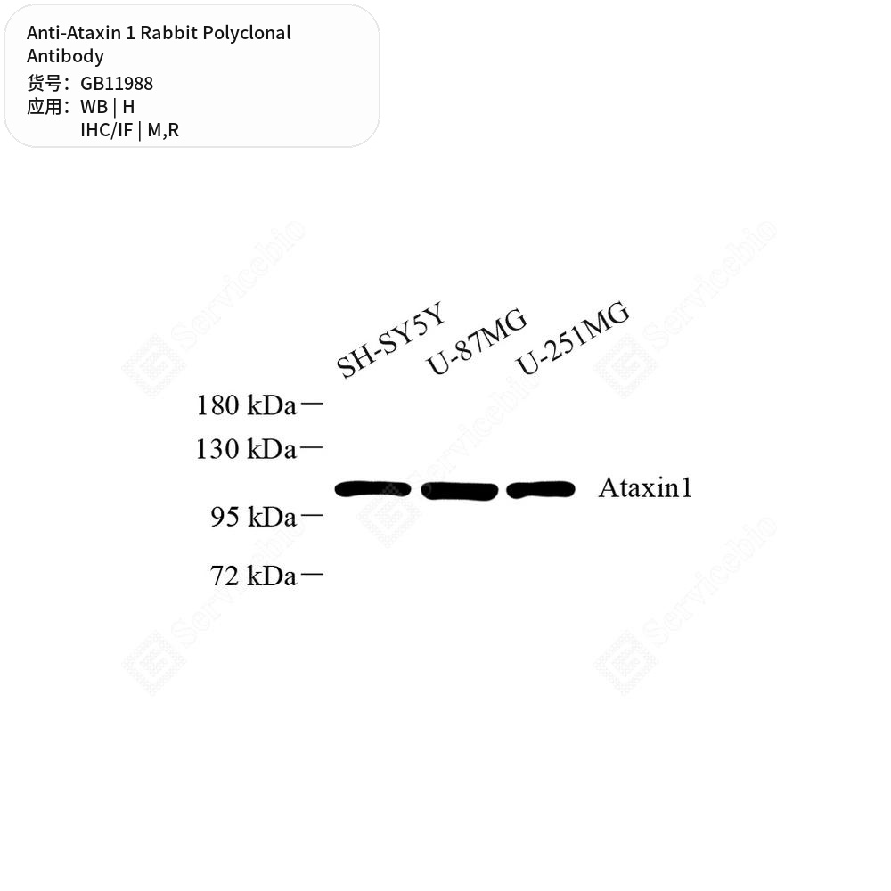 Антитела первичные, поликлональные кролика к Ataxin 1 крысы, мыши, человека, 50 мкл