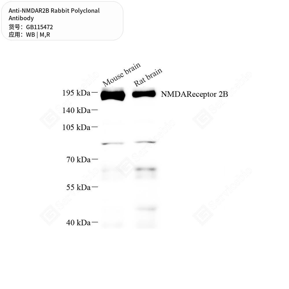 Антитела первичные, поликлональные кролика к NMDAR2B крысы, мыши, 50 мкл