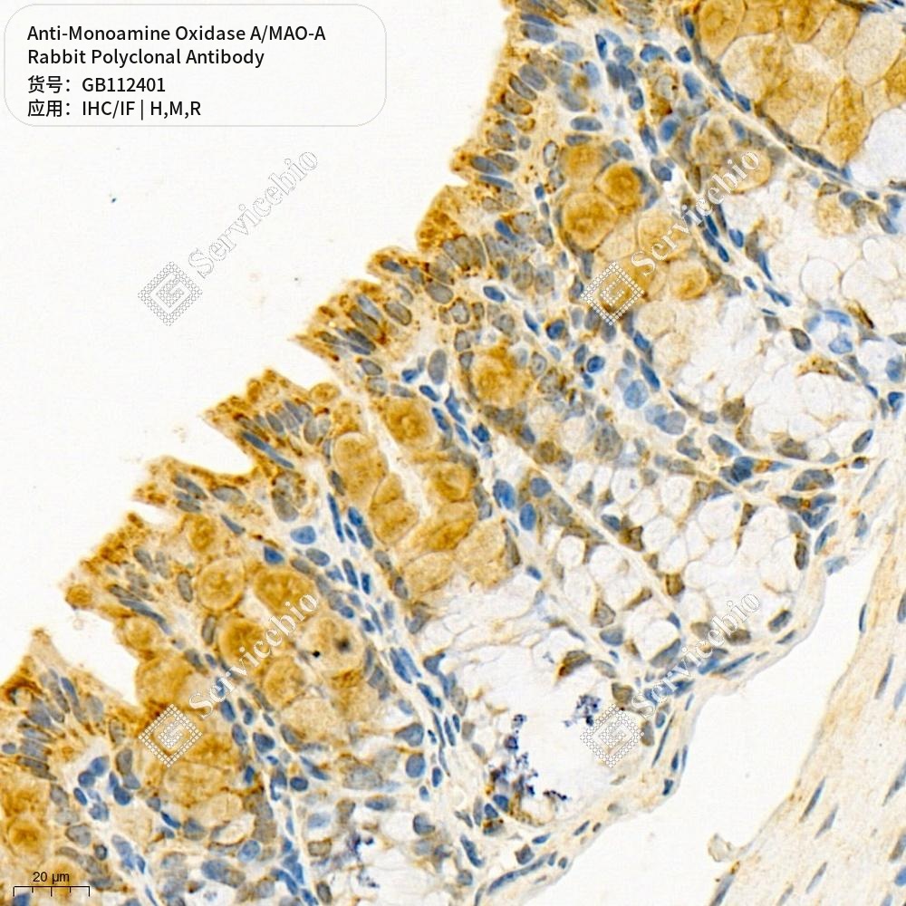 Антитела первичные, поликл. кролика к Monoamine Oxidase A/MAO-A крысы, мыши, человека, 100 мкл