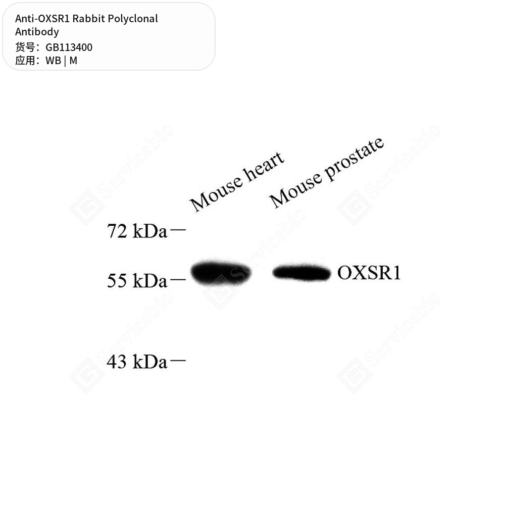 Антитела первичные, поликлональные кролика к OXSR1 мыши, 100 мкл