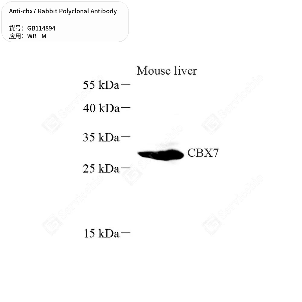 Антитела первичные, поликлональные кролика к cbx7 мыши, 50 мкл
