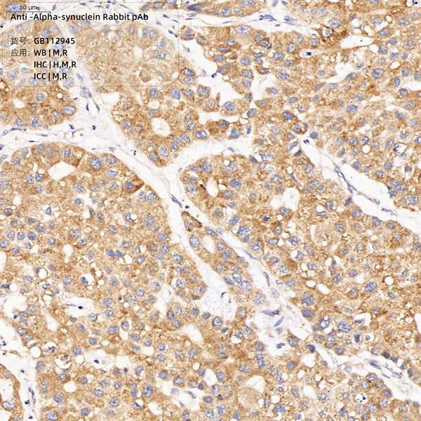 Антитела первичные, поликлональные, alpha-synuclein, 100 мкл