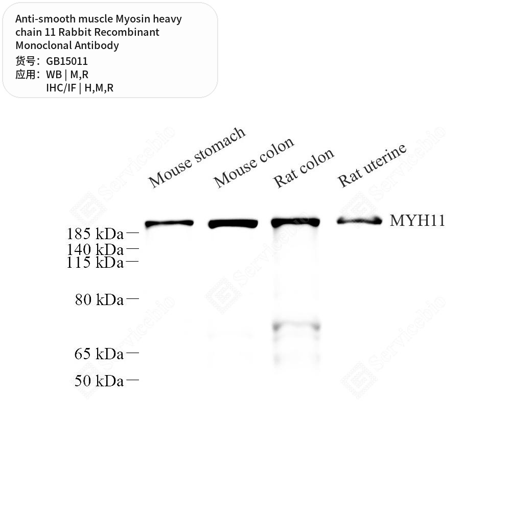 Антитела первичные, монок. крол. к smooth muscle Myosin heavy chain 11 крысы, мыши, чел., 50 мкл