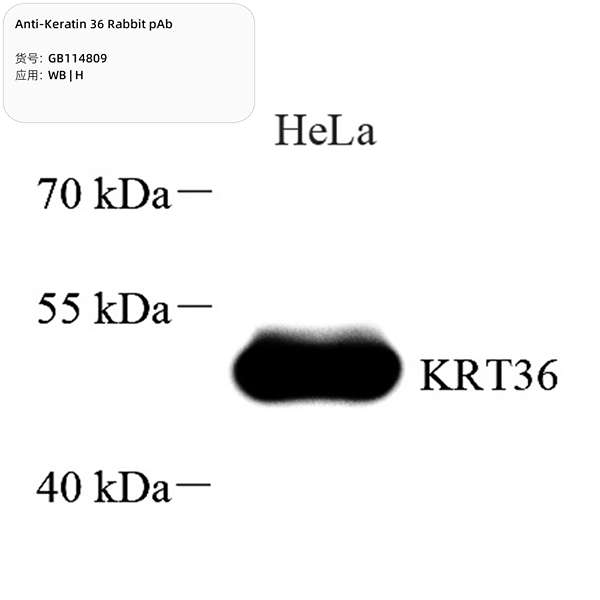 Антитела первичные, поликлональные, Keratin 36, 100 мкл