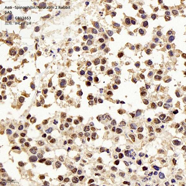Антитела первичные, поликлональные, Spinophilin/Neurabin 2, 100 мкл