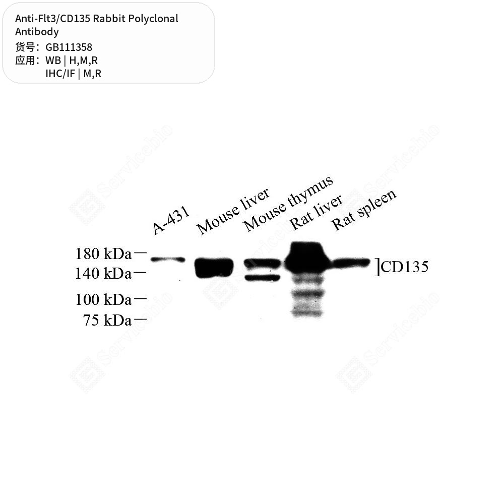 Антитела первичные, поликлональные кролика к Flt3/CD135 крысы, мыши, человека, 100 мкл