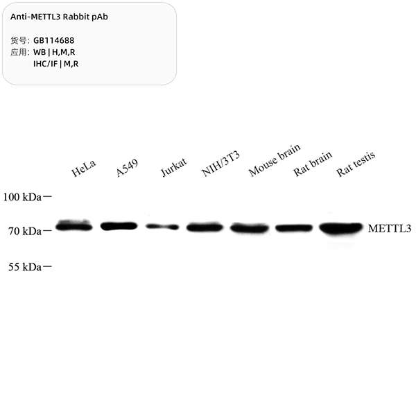 Антитела первичные, поликлональные, METTL3, 100 мкл
