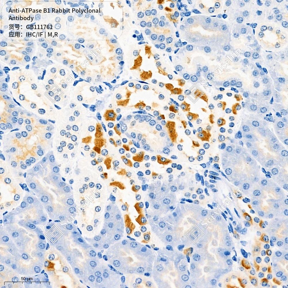 Антитела первичные, поликлональные кролика к ATPase B1 крысы, мыши, 100 мкл