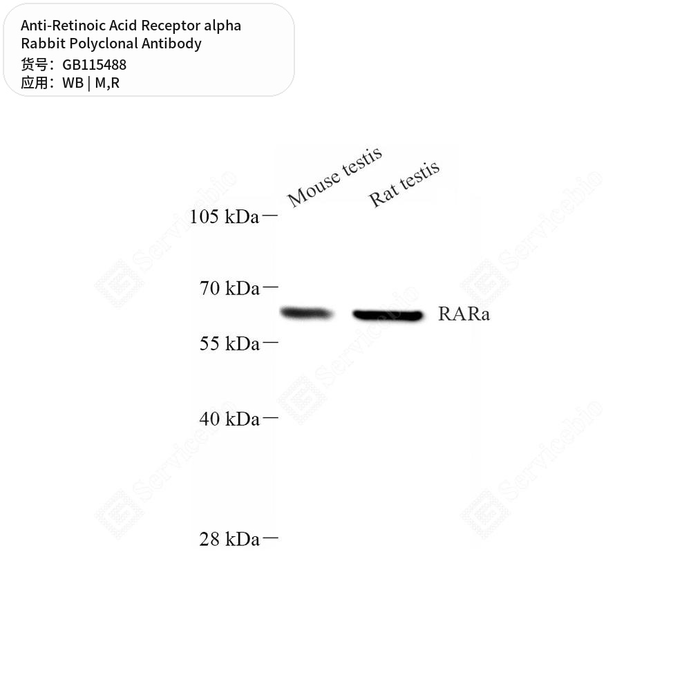 Антитела первичные, поликлональные кролика к Retinoic Acid Receptor alpha крысы, мыши, 50 мкл