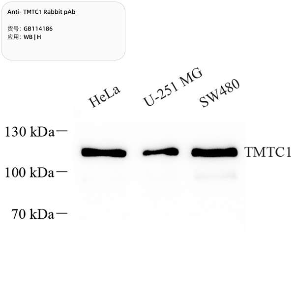 Антитела первичные, поликлональные, TMTC1, 100 мкл