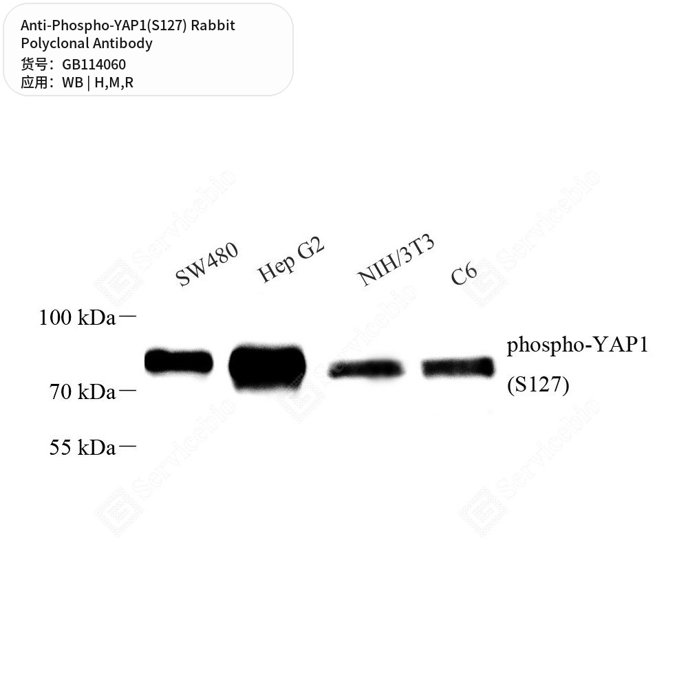 Антитела первичные, поликлональные кролика к Phospho-YAP1(S127) крысы, мыши, человека, 100 мкл
