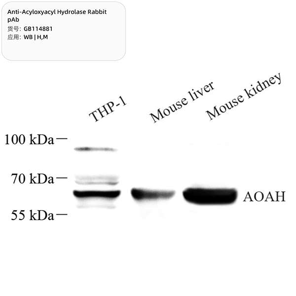 Антитела первичные, поликлональные, Acyloxyacyl Hydrolase, 100 мкл