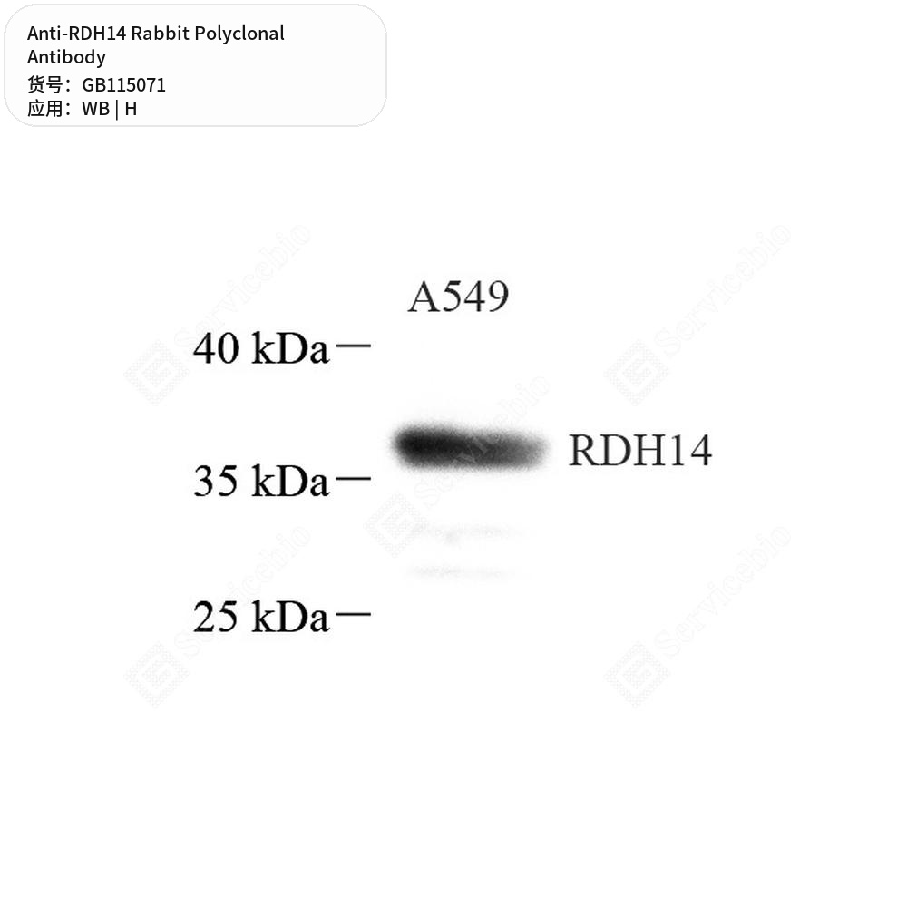 Антитела первичные, поликлональные кролика к RDH14 человека, 50 мкл