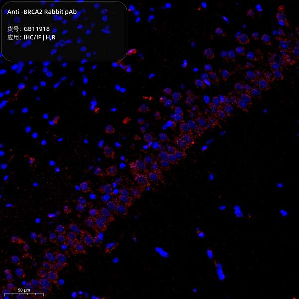 Антитела первичные, поликлональные, BRCA2, 100 мкл