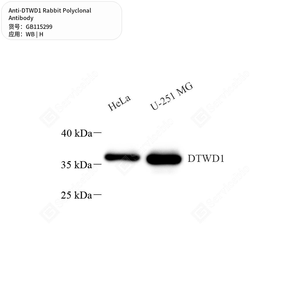 Антитела первичные, поликлональные кролика к DTWD1 человека, 50 мкл