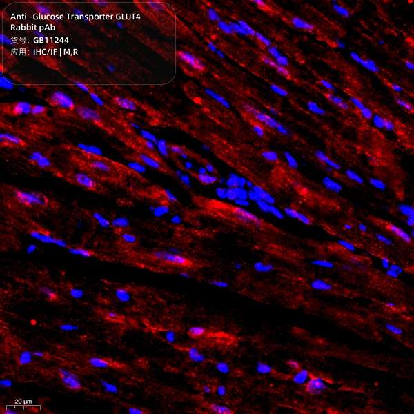 Антитела первичные, поликлональные, Glucose Transporter GLUT4, 100 мкл