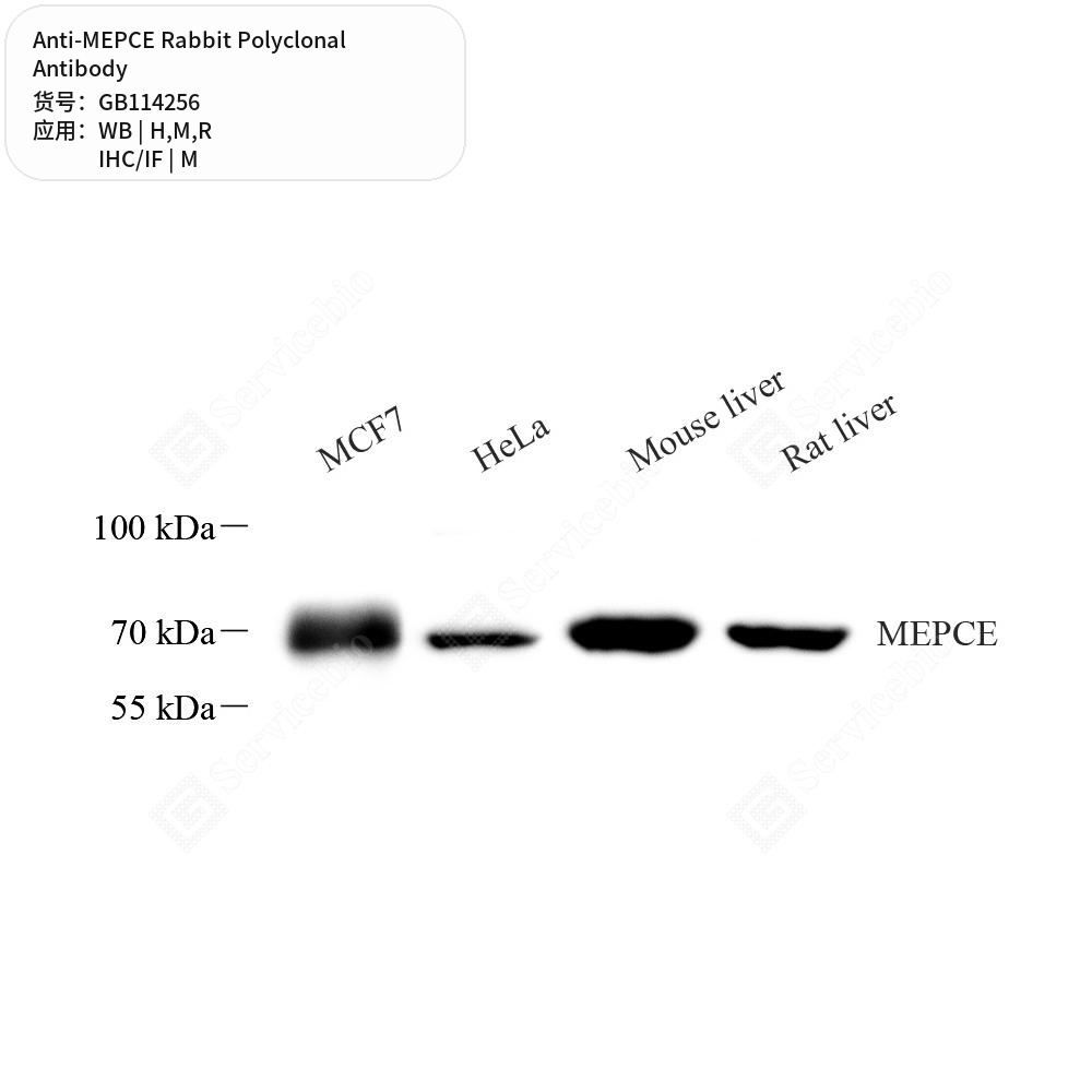 Антитела первичные, поликлональные кролика к MEPCE крысы, мыши, человека, 50 мкл