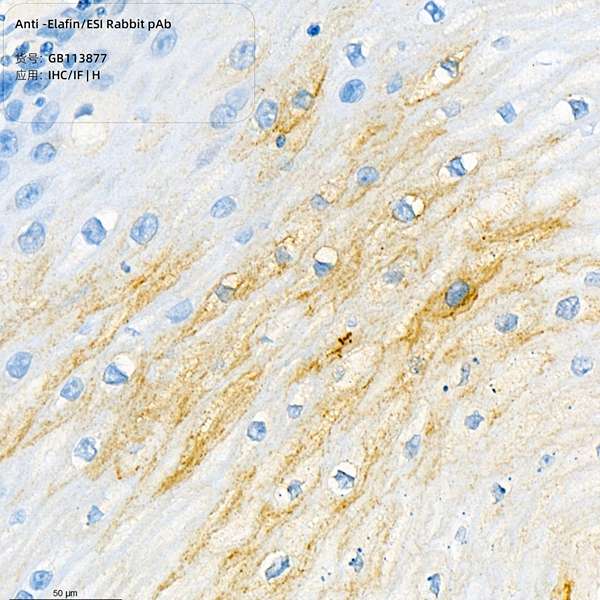 Антитела первичные, поликлональные, Elafin/ESI, 100 мкл