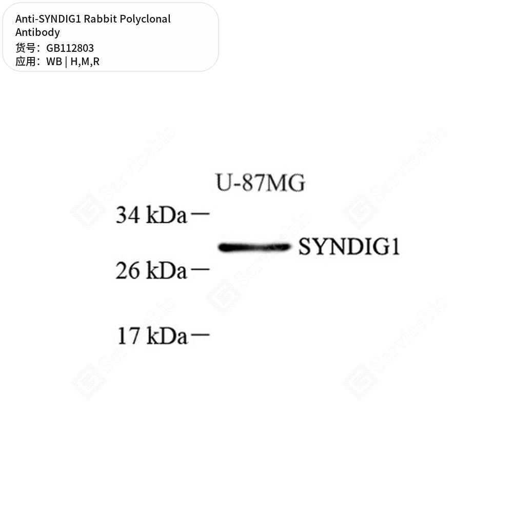 Антитела первичные, поликлональные кролика к SYNDIG1 крысы, мыши, человека, 100 мкл