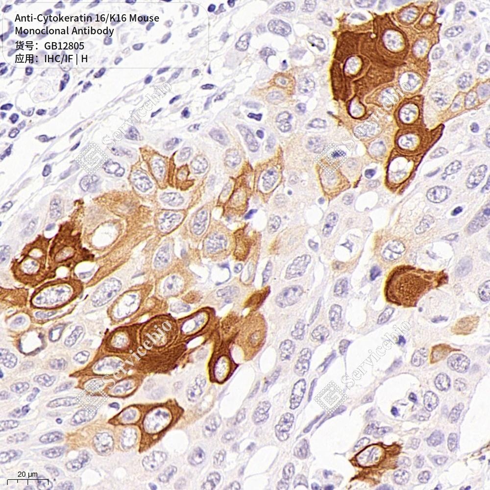 Антитела первичные, моноклональные мыши к Cytokeratin 16/K16 человека, 100 мкл