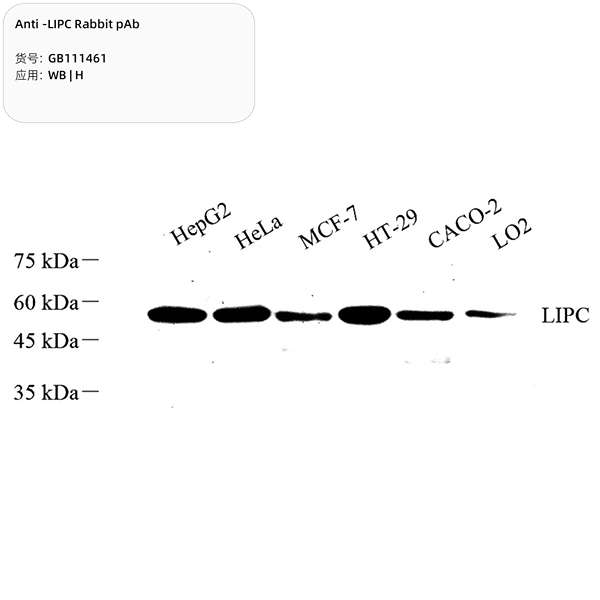 Антитела первичные, поликлональные, LIPC, 100 мкл