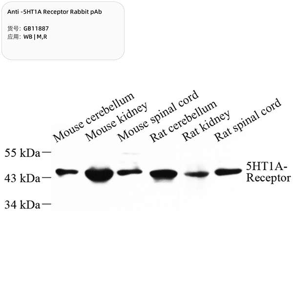 Антитела первичные, поликлональные, 5HT1A Receptor, 100 мкл