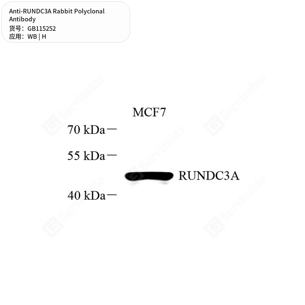 Антитела первичные, поликлональные кролика к RUNDC3A человека, 100 мкл