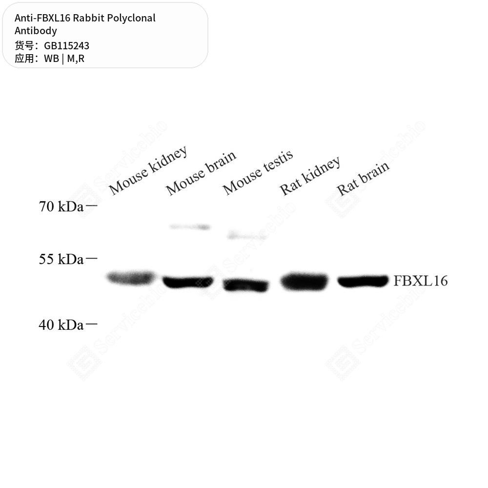 Антитела первичные, поликлональные кролика к FBXL16 крысы, мыши, 50 мкл