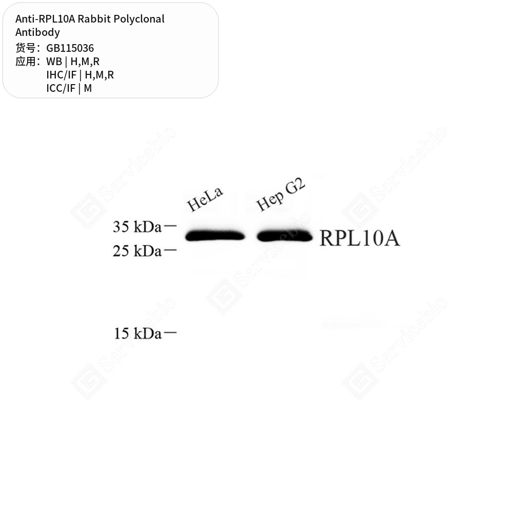Антитела первичные, поликлональные кролика к RPL10A крысы, мыши, человека, 50 мкл