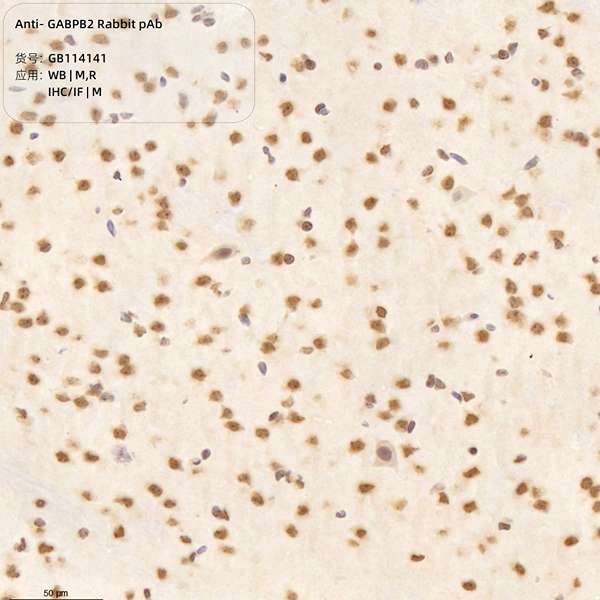 Антитела первичные, поликлональные, GABPB2, 100 мкл