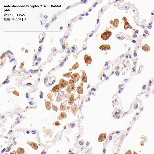 Антитела первичные, поликлональные, Mannose Receptor/CD206, 100 мкл