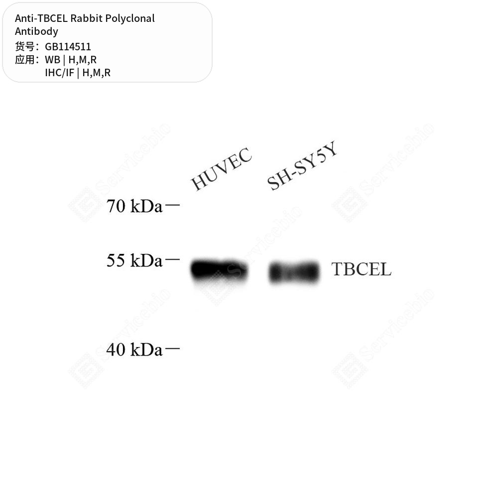 Антитела первичные, поликлональные кролика к TBCEL крысы, мыши, человека, 100 мкл