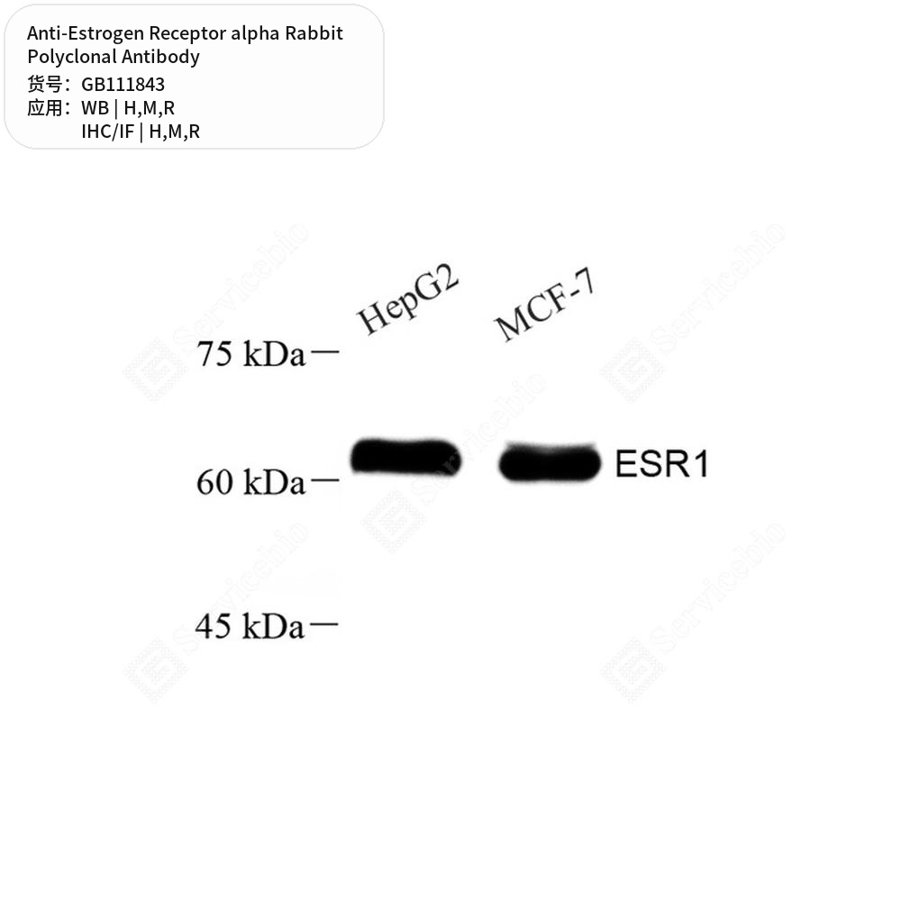 Антитела первичные, поликлональные кролика к Estrogen Receptor alpha крысы, мыши, человека, 100 мкл