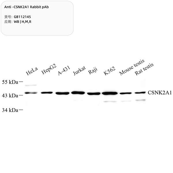 Антитела первичные, поликлональные, CSNK2A1, 100 мкл