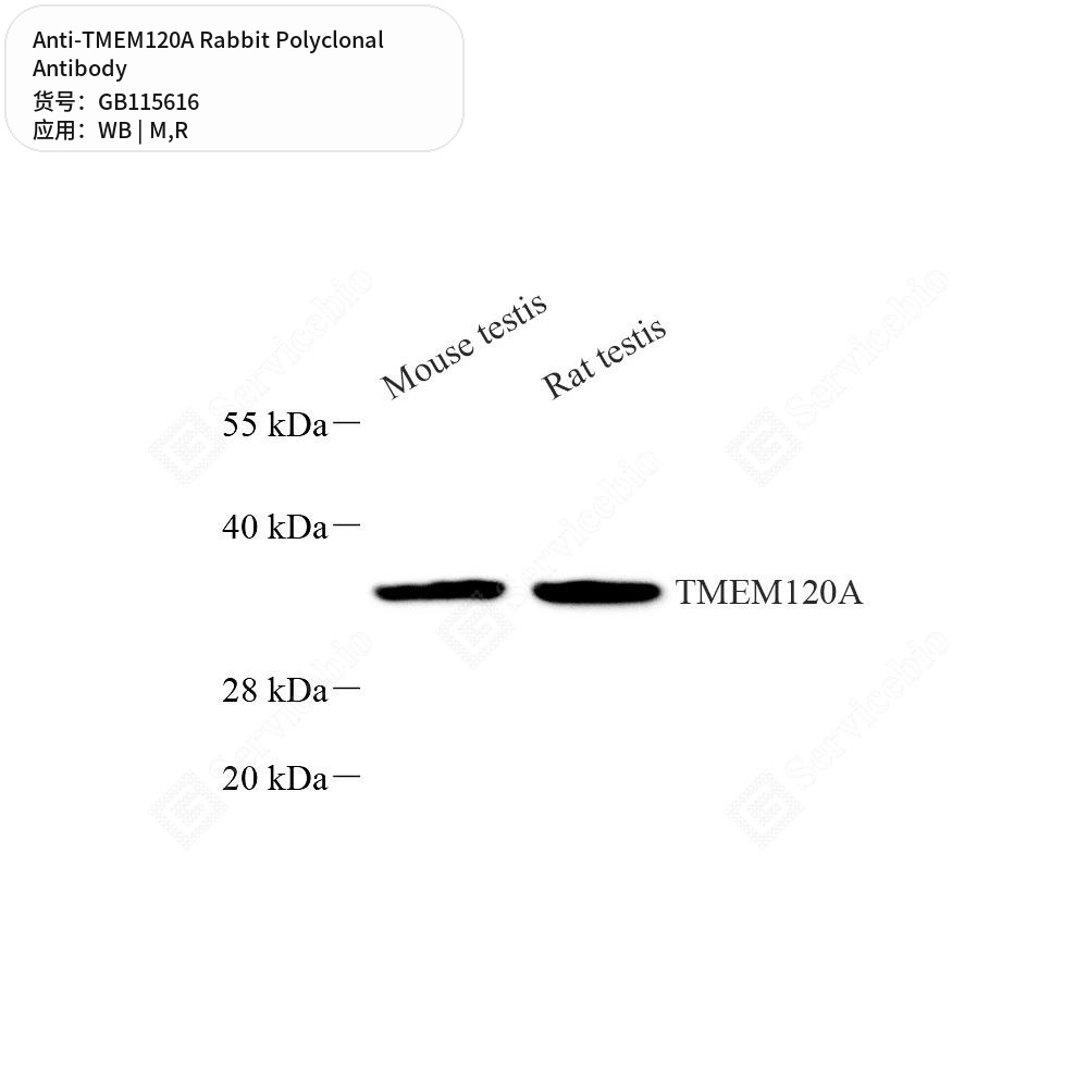 Антитела первичные, поликлональные кролика к TMEM120A крысы, мыши, 50 мкл