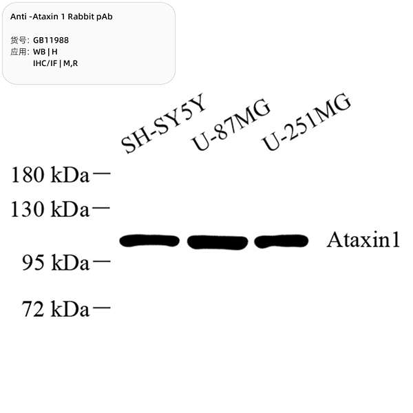 Антитела первичные, поликлональные, Ataxin 1, 100 мкл