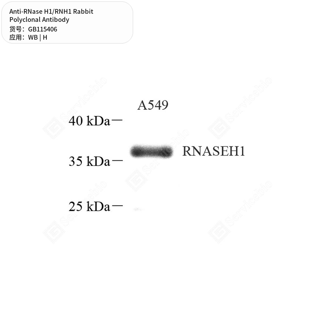 Антитела первичные, поликлональные кролика к RNase H1/RNH1 человека, 50 мкл