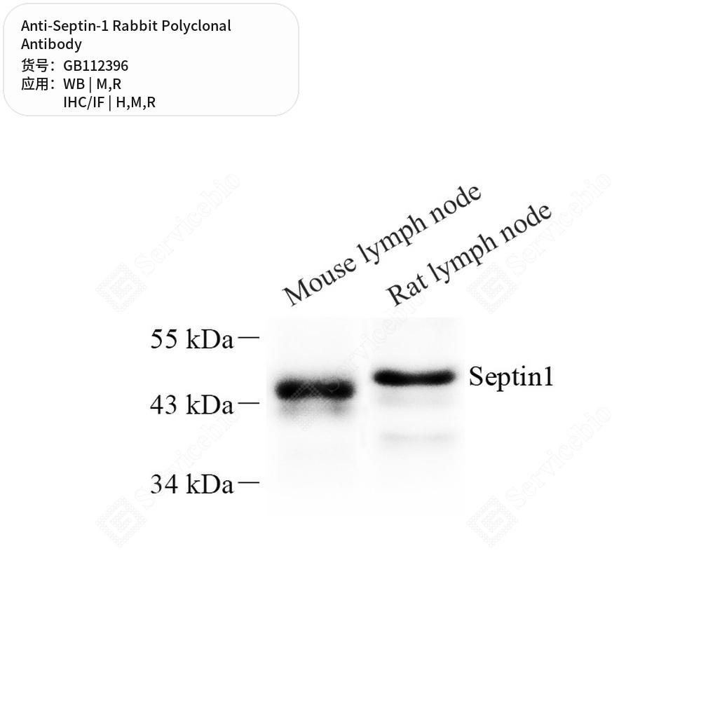 Антитела первичные, поликлональные кролика к Septin-1 крысы, мыши, человека, 100 мкл