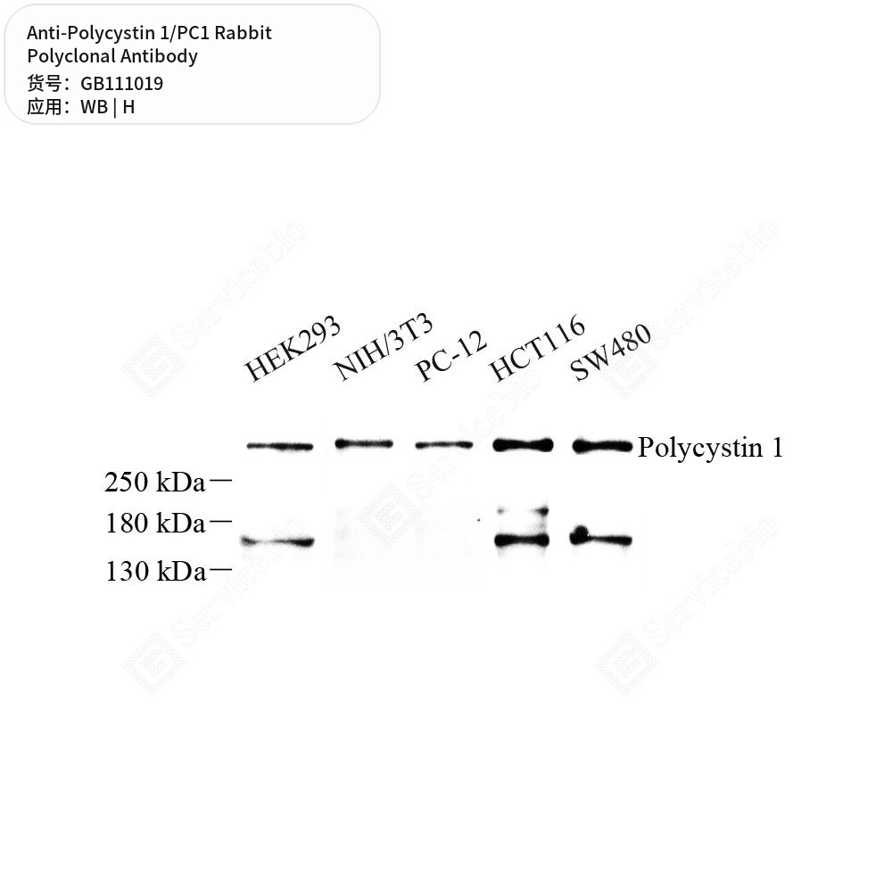 Антитела первичные, поликлональные кролика к Polycystin 1/PC1 человека, 100 мкл