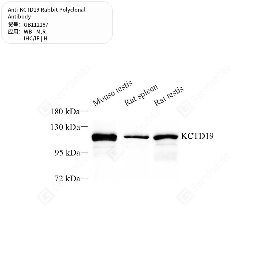 Антитела первичные, поликлональные кролика к KCTD19 крысы, мыши, человека, 100 мкл