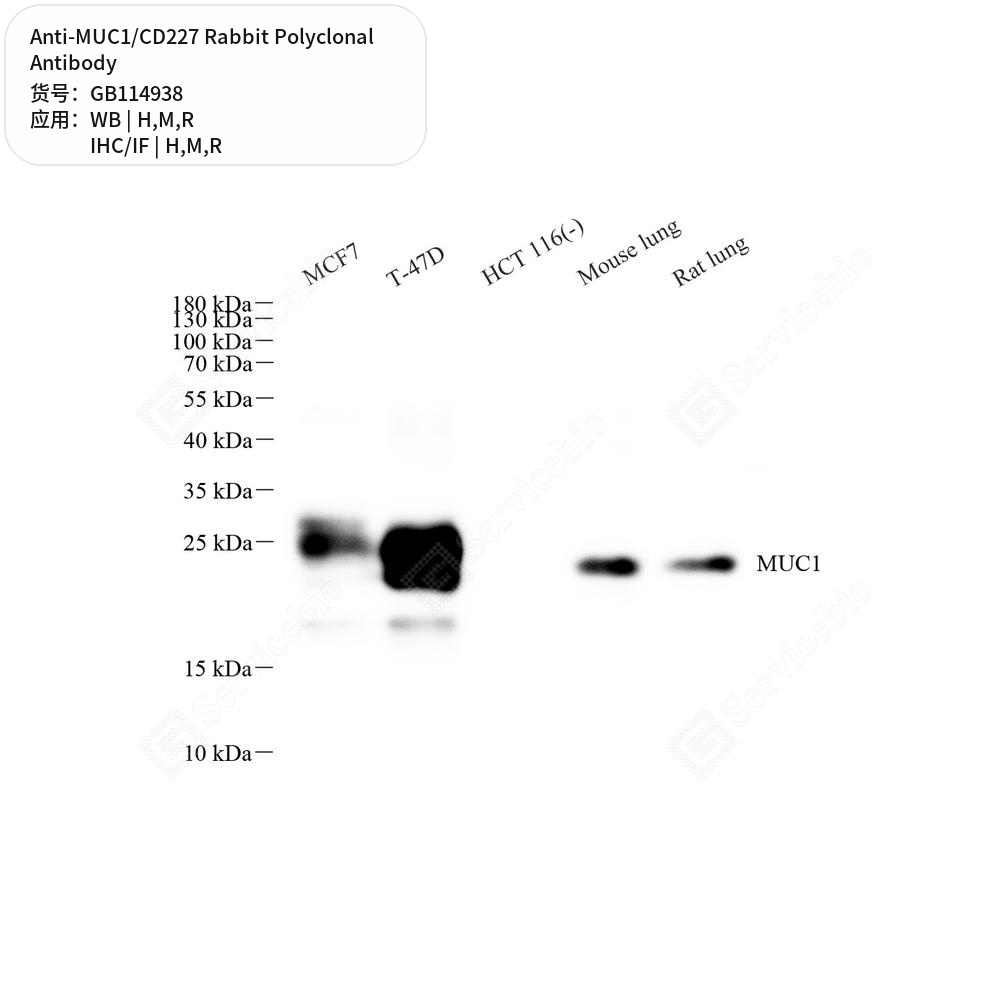 Антитела первичные, поликлональные кролика к MUC1/CD227 крысы, мыши, человека, 50 мкл