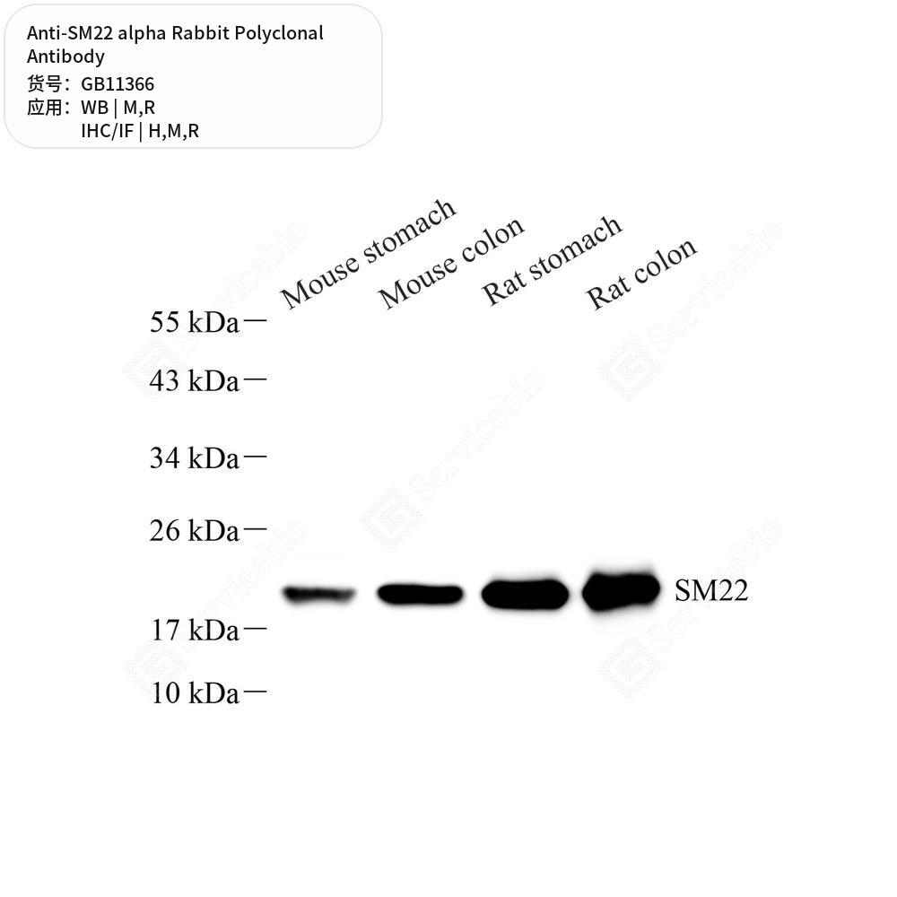 Антитела первичные, поликлональные кролика к SM22 alpha крысы, мыши, человека, 100 мкл