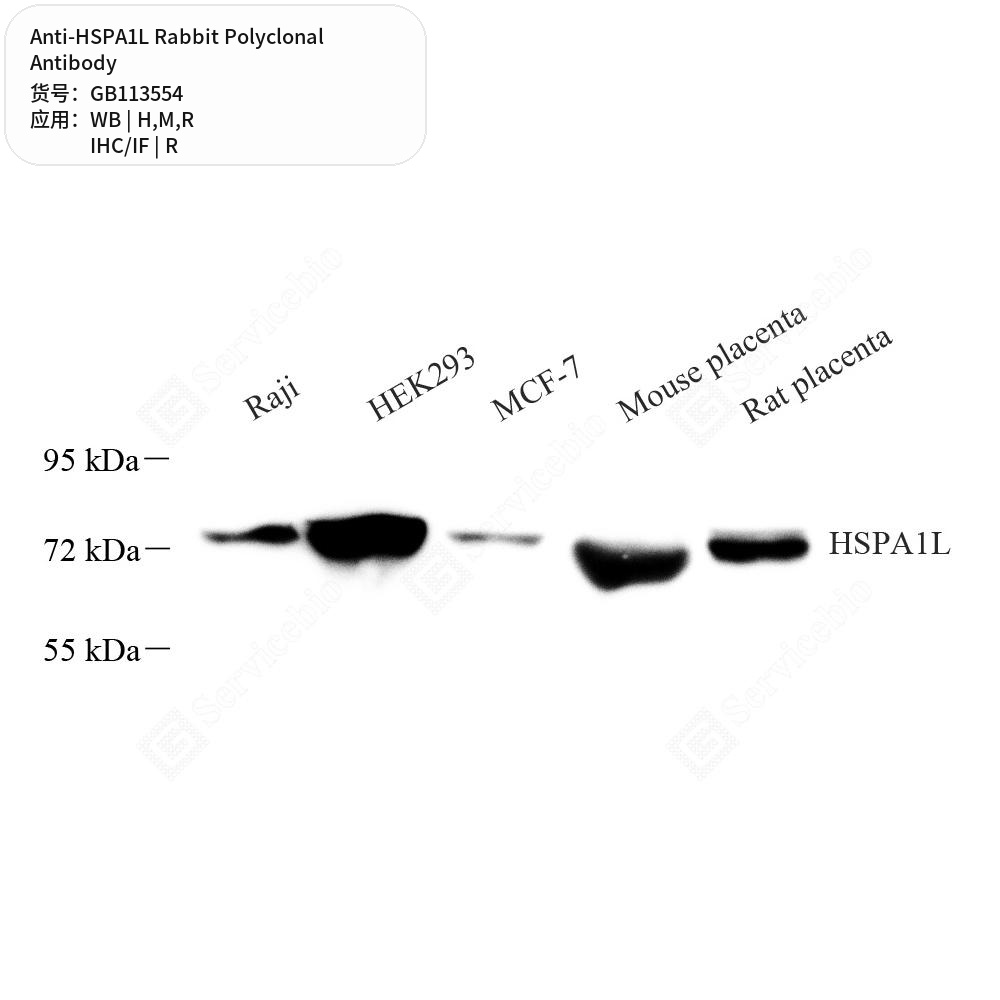 Антитела первичные, поликлональные кролика к HSPA1L крысы, мыши, человека, 50 мкл